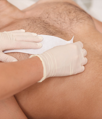 Tractaments depilació home Tractaments depilació home